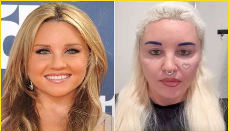 Edward Norton Plastic Surgery Before and After